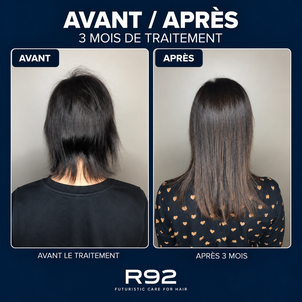 R92 — Gummies pousse cheveux