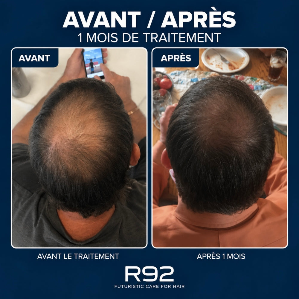 R92 — Gummies pousse cheveux