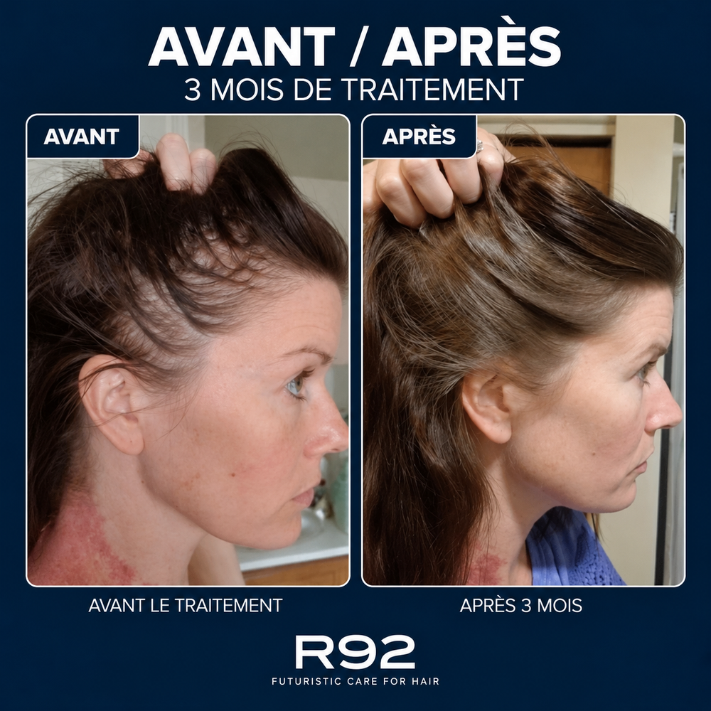 R92 — Gummies pousse cheveux